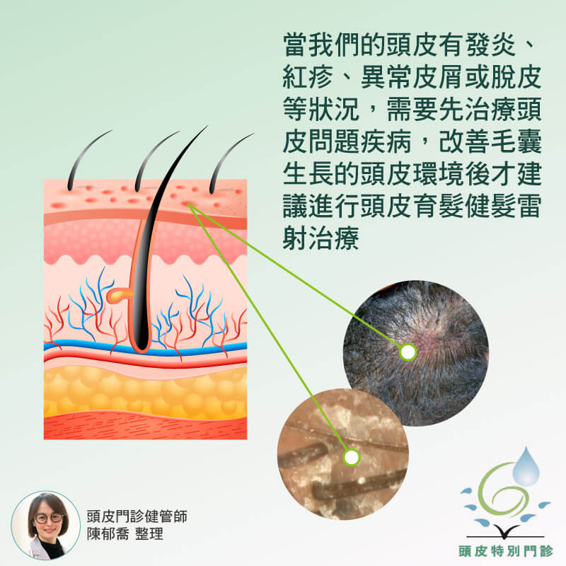 頭皮有發炎、紅疹可以做育髮健髮雷射嗎？