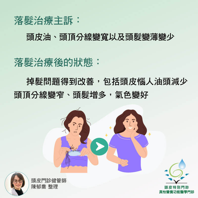 落髮治療改善前狀況與改善後的狀態