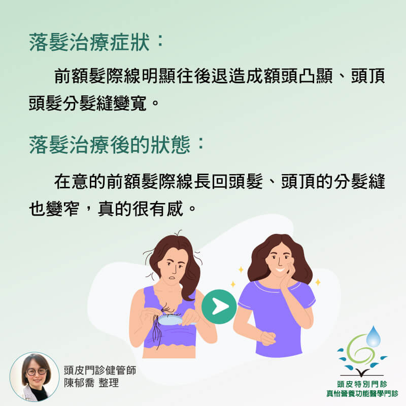 頭皮治療前後症狀狀況