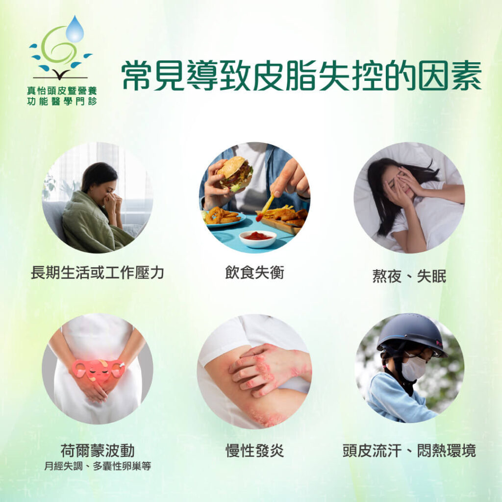 頭皮 皮脂失控的因素
